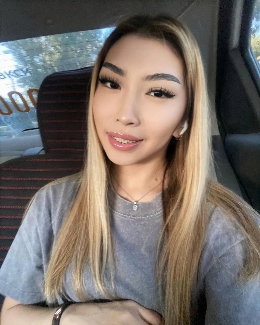 AF-FS-T030 Donor profile photograph
