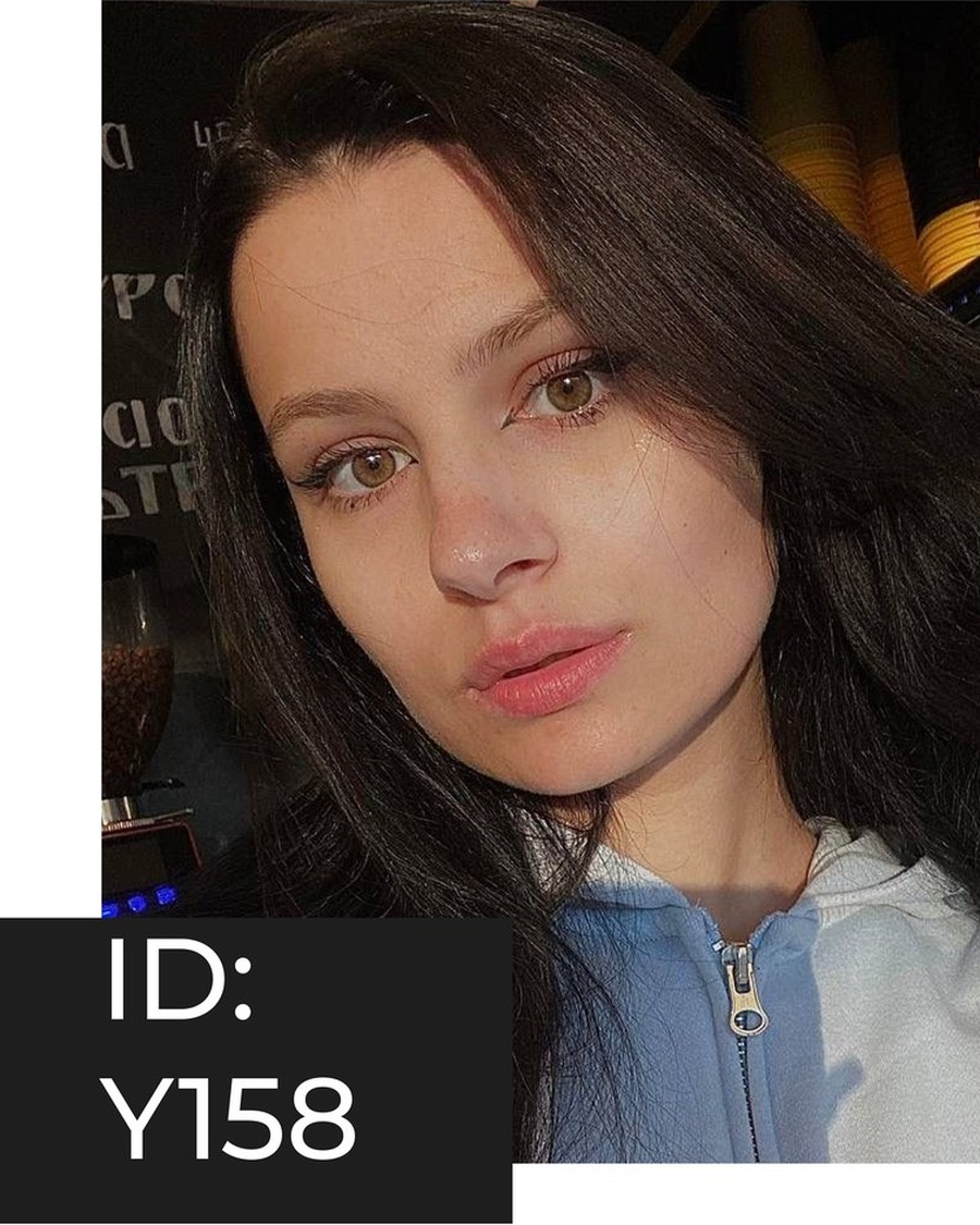 AF-FS-Y158 Donor profile photograph