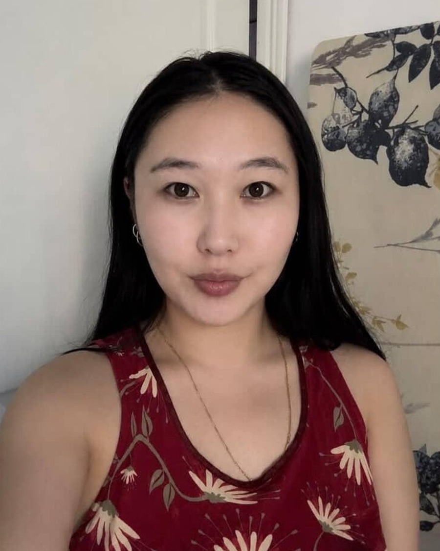 AG-FS-81008 Donor profile photograph