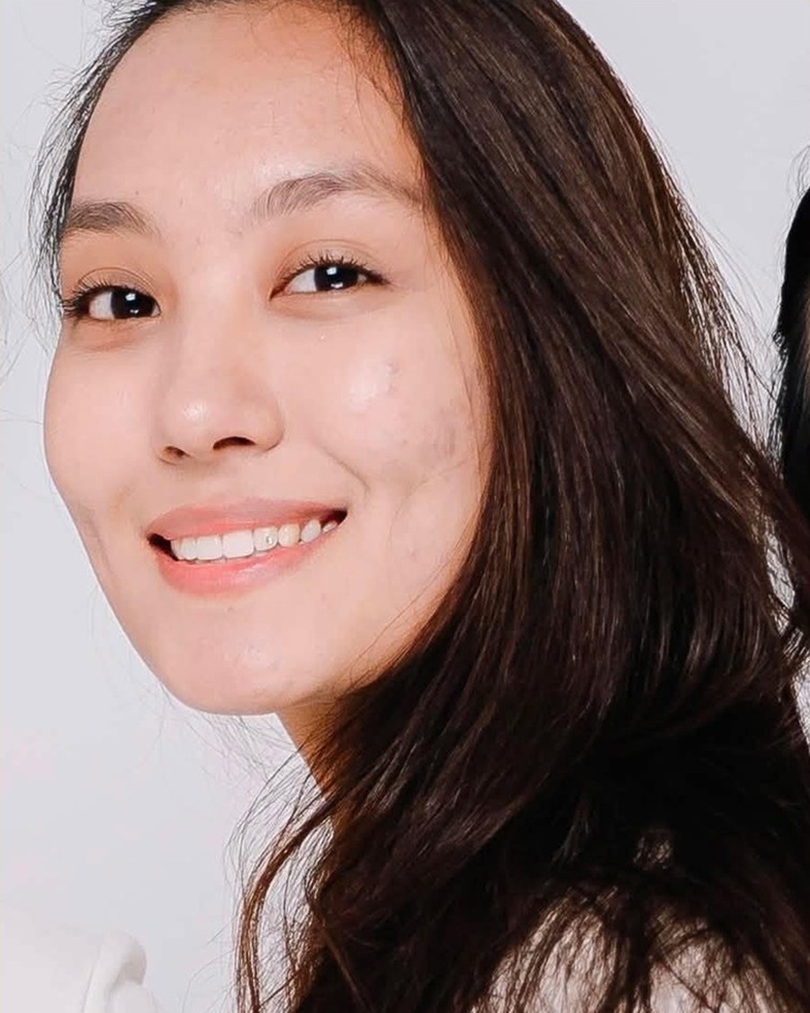 AG-FS-81013 Donor profile photograph
