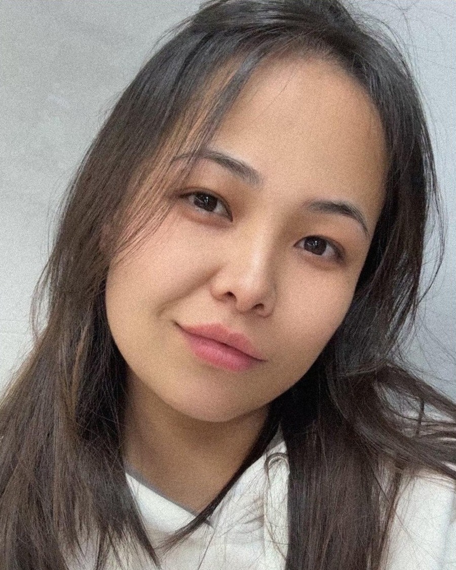 AG-FS-81017 Donor profile photograph