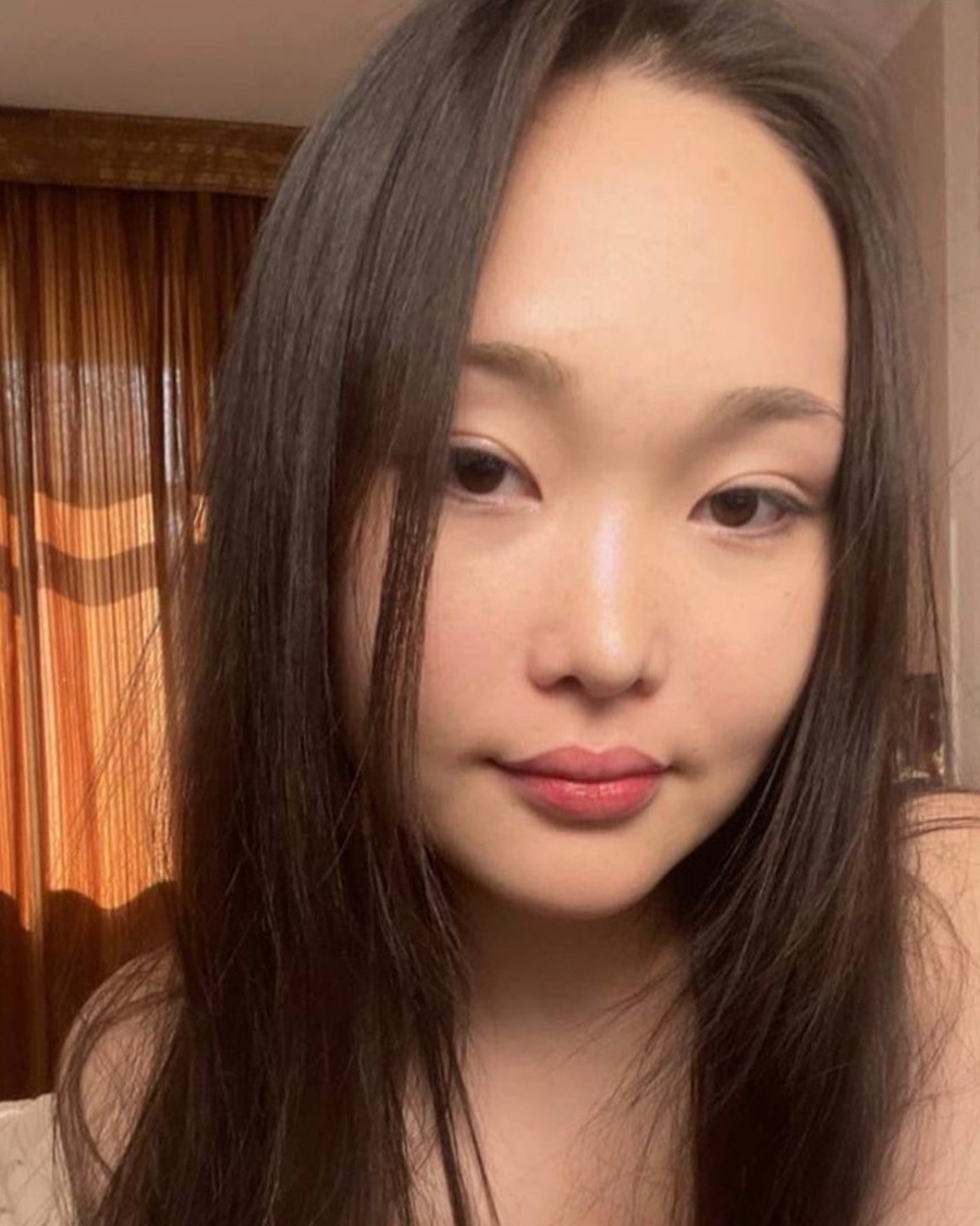 FS-MD-M022 Donor profile photograph