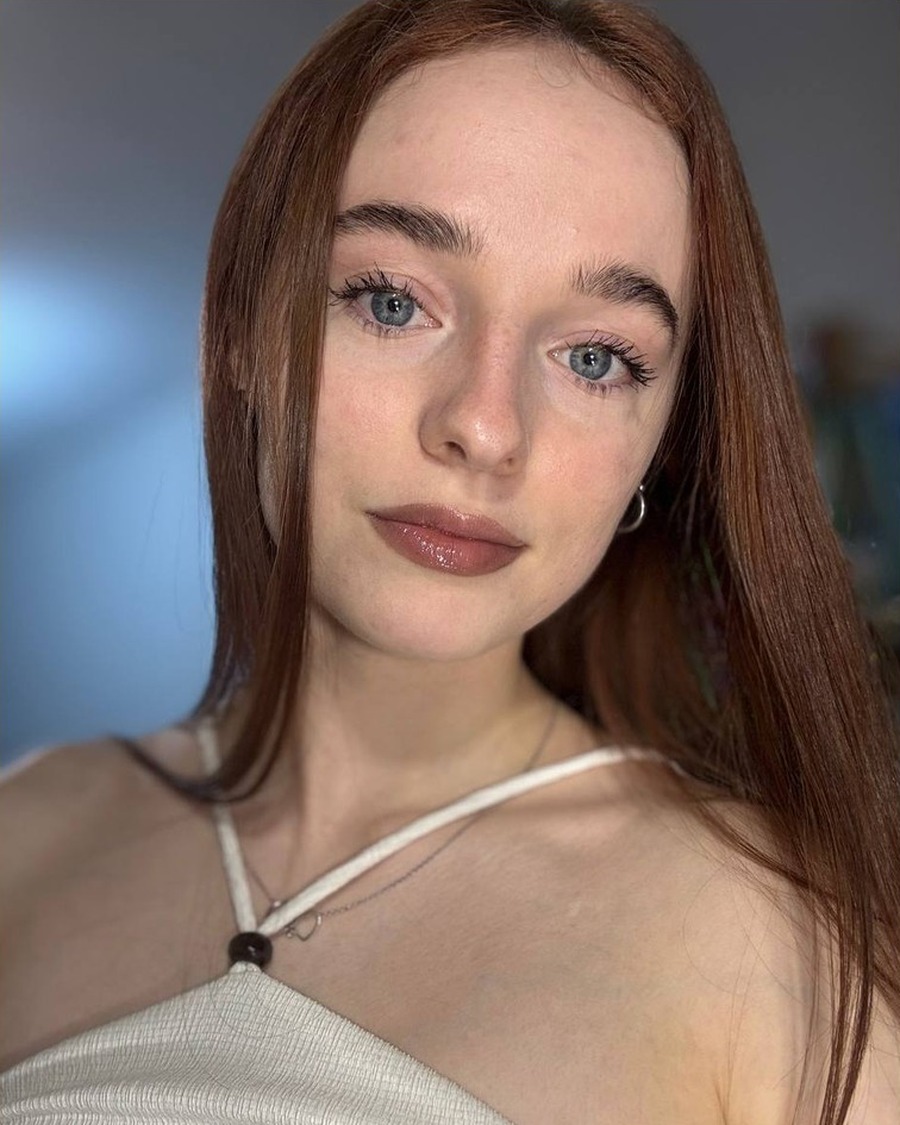 FS-MD-M151 Donor profile photograph