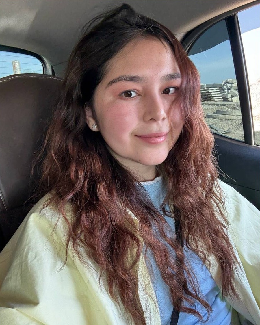FS-MD-M157 Donor profile photograph