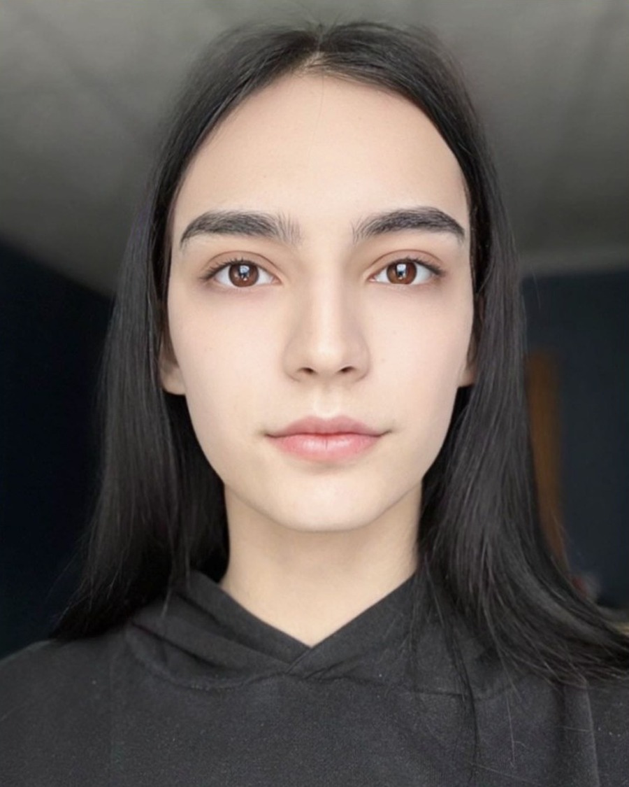 FS-N-237 Donor profile photograph