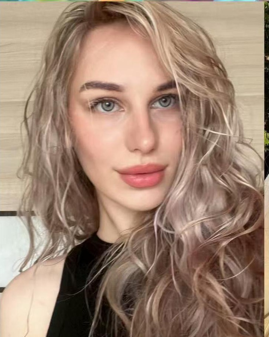 TH-FS-ALVENA Фотография из профиля донора